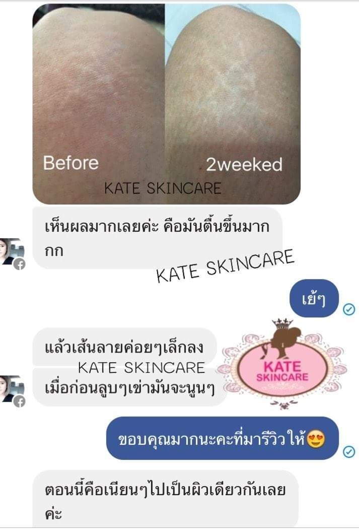 Review-KATE SKINCARE (2)