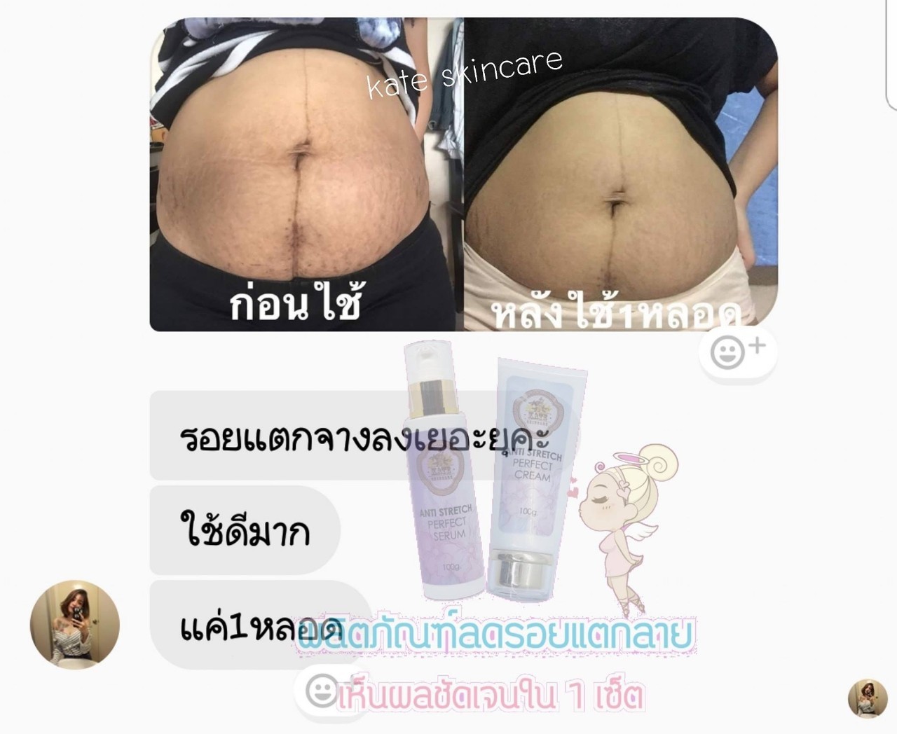 Review-KATE SKINCARE (5)