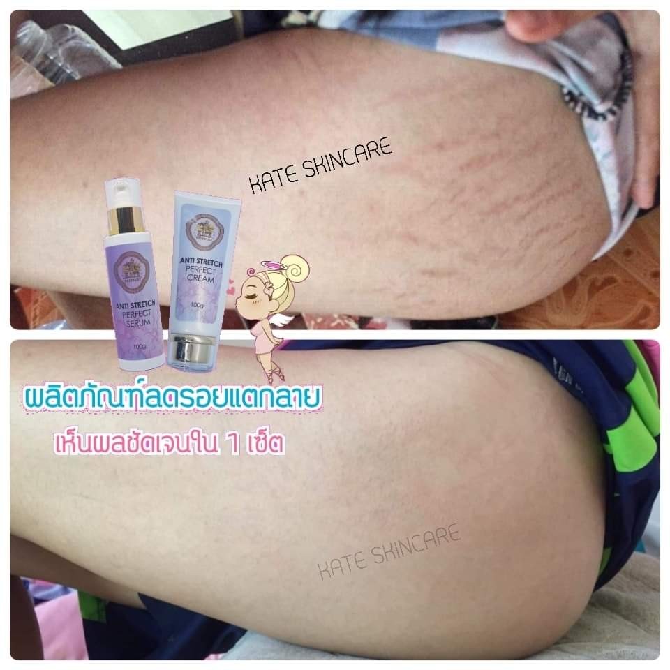 Review-KATE SKINCARE (9)